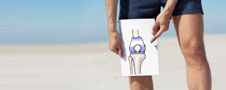 Osteoarthritis Knee, painful knee