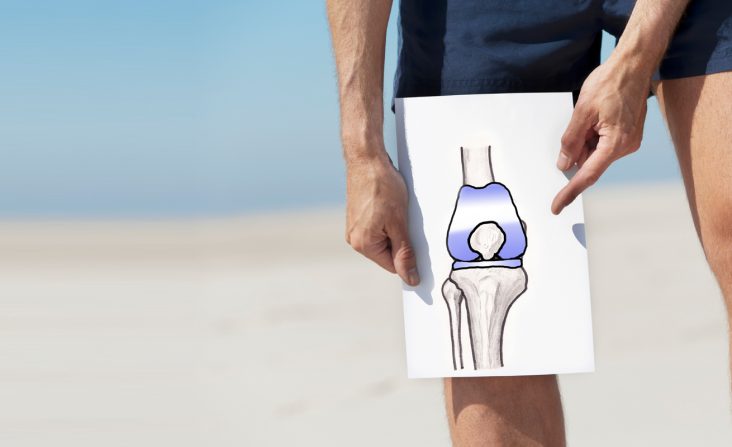 Osteoarthritis Knee, painful knee